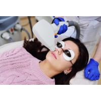 Upper lip Laser hair removal (Coupon)